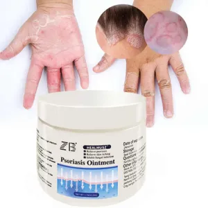 ZB Psoriasis Cream for Dermatitis and- لعلاج الصدفية والتهاب